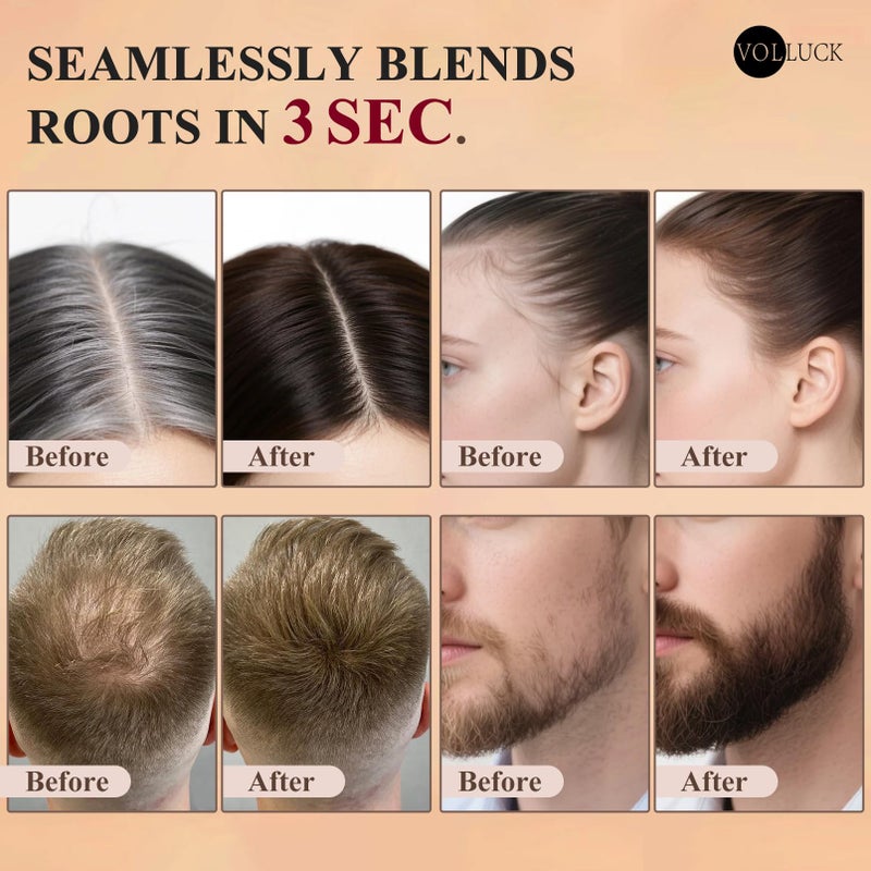 VOLLUCK Hairline Powder Instantly, Root Touch up Powder Hair Color Upgraded, Grey Root Cover up Conceals Hair Loss, Hairline Shadow for Women & Men for Thinning Hair Natural, Sweatproof (Brown) - Image 3